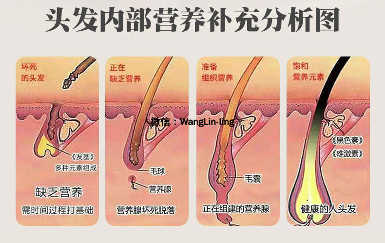 在线客服(微信号：WangLin-ling)