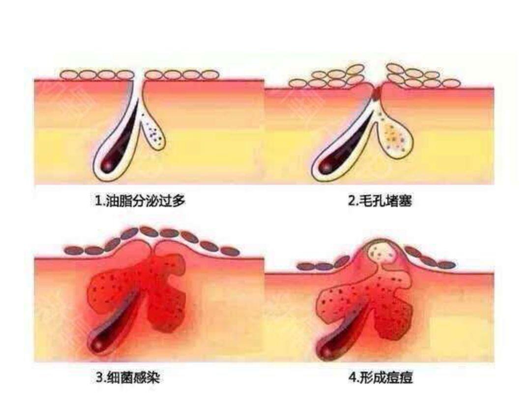 琳玲港货